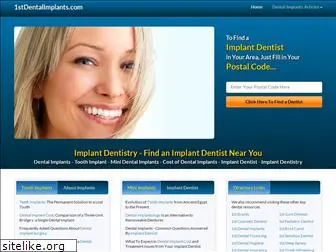 1stdentalimplants.com