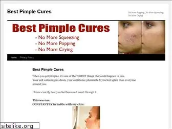 bestpimplecures.com