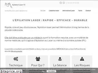 epilationlaser73.fr