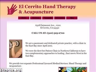 handtherapyandacupuncture.com