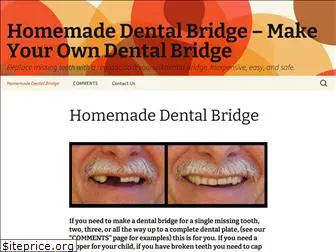 homemadedentalbridge.com