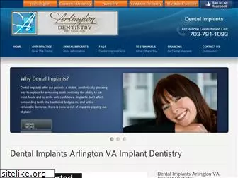 implantdentistryarlingtonva.com