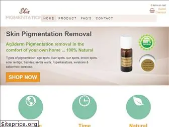 skinpigmentation.net