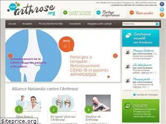 stop-arthrose.org