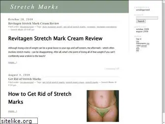stretchmarks.net